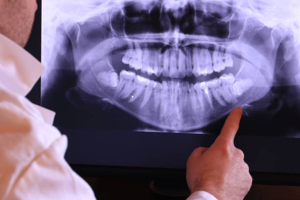 Best Emergency Dentist for Knocked-Out Tooth in Chino, CA