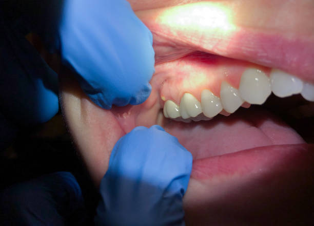 Best Emergency Dentist for Knocked-Out Tooth in Chino, CA