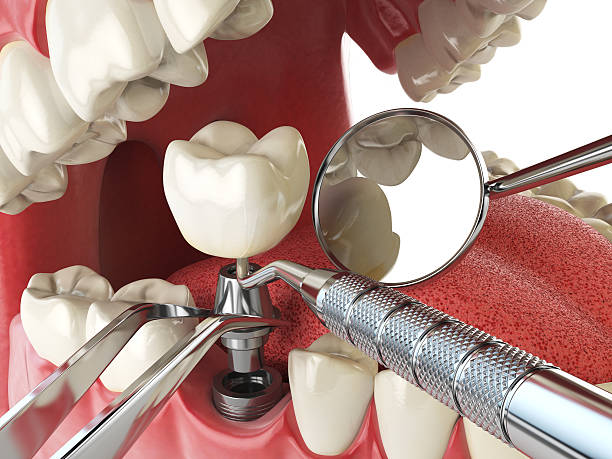 Best Mobile Emergency Dentist in Chino, CA